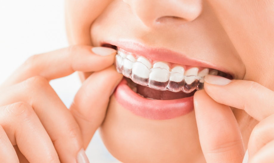 professional_teeth_whitening_Delray_Beach